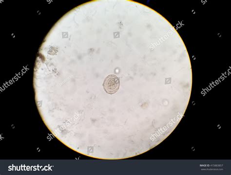 Hymenolepis Diminuta Egg Stool Under Microscope Stock Photo 415883857 ...