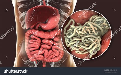 Parasitic Worms Human Intestine 3d Illustration Stock Illustration