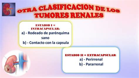 Clasificaci N De Los Tumores Zabala Flores Carla Patricia Udocz