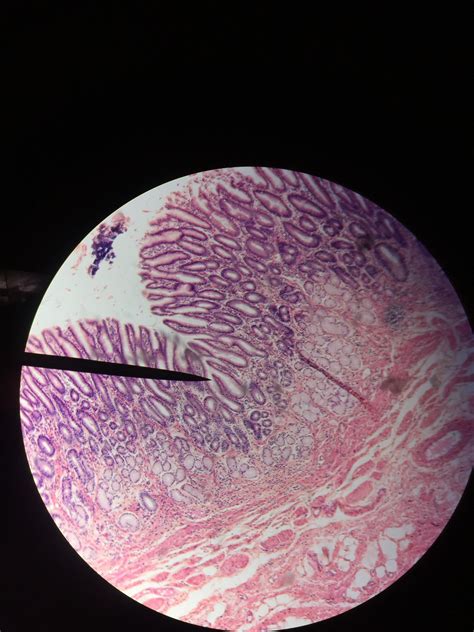 Simple squamous epithelium – Artofit