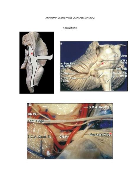 Anatomía de los Pares Craneales Anexo 2 Iair Braun uDocz