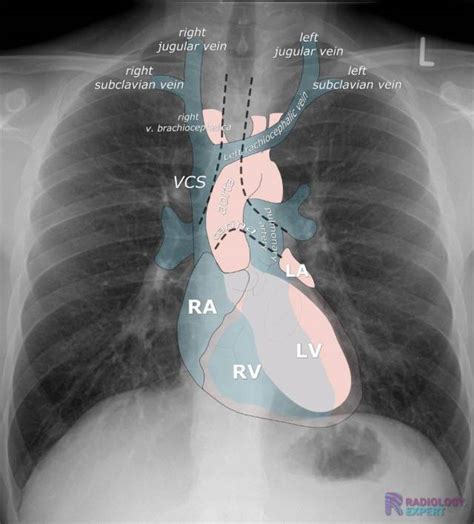 X Ray Heart Anatomy