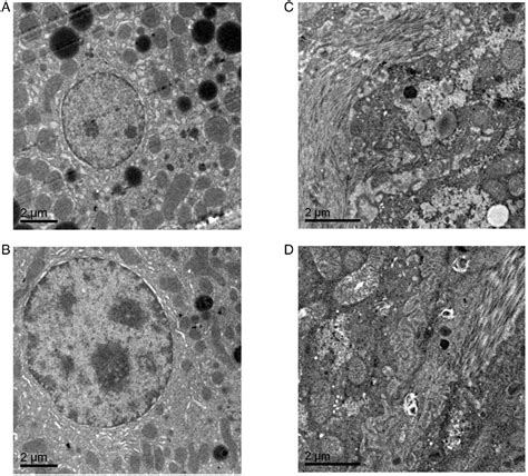 Figure 6 From Sex Differences In Diabetesinduced Hepatic And Renal Damage Semantic Scholar