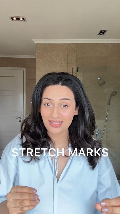 how much does it cost to remove stretch marks