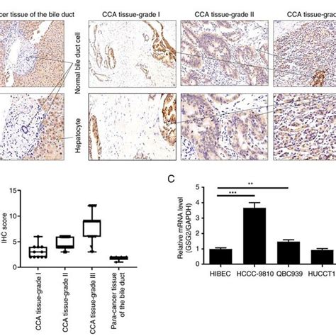 Gsg Is Highly Expressed In Cca A Expression Levels Of Gsg In Cca