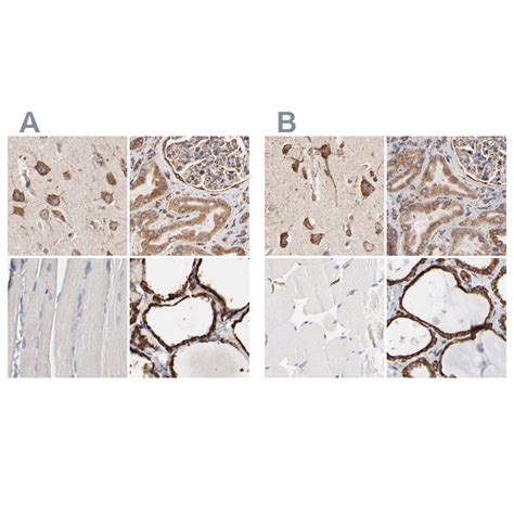 Anti Pdia Rabbit Polyclonal Biozol