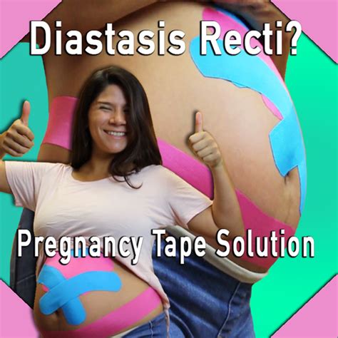 Pregnancy Taping For Diastasis Recti Abdominal Seperation Cozy Bump