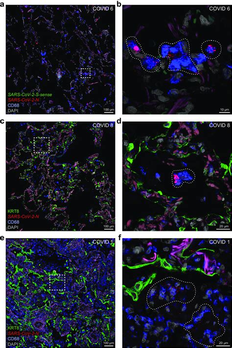 Macrophages in alveolar walls and alveolar spaces. Confocal images of ...