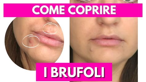 Come Coprire I Brufoli Grandi E Piccoli Col Make Up Youtube