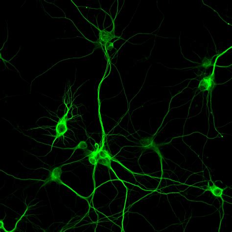 Primary Neuron From A Rat Cortex Supplied By Transnetyx Tissue By