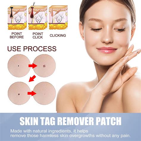 EELHOE Skin T-ag Remover Patches Mole Wart Removing Sticker Natural