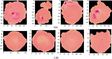 Illustration of sample malaria cell images: (a) Infected images; (b ...