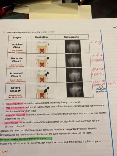 Board Review Flashcards Quizlet