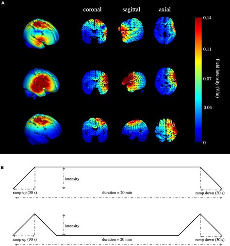 Frontiers Multitarget High Definition Transcranial Direct Current