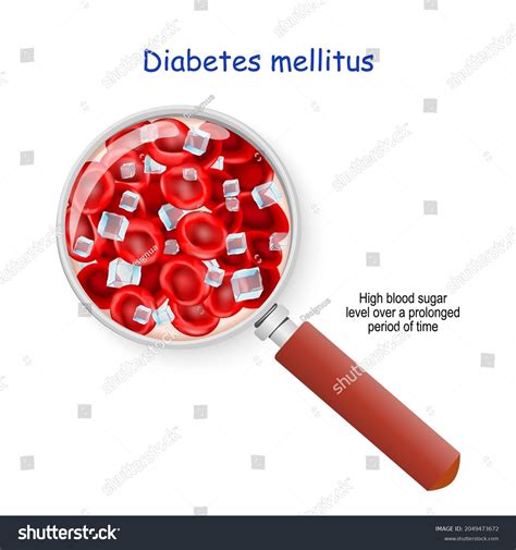 8 Blood Glucose Over Time Images, Stock Photos & Vectors | Shutterstock