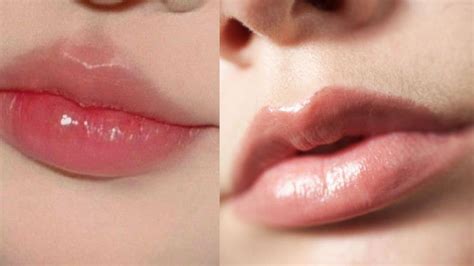 Cuál es el arco de cupido Descubre si tienes el rasgo facial en tendencia