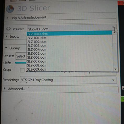 Downloading A Dicom Folder Support 3d Slicer Community