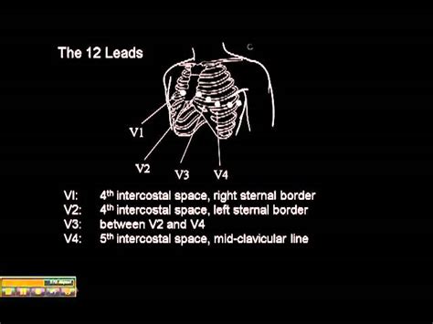 Pediatric 15 Lead ECG Placement