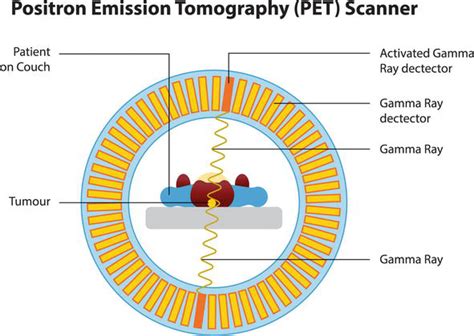 Pet Ct Imaging And Applications Intechopen