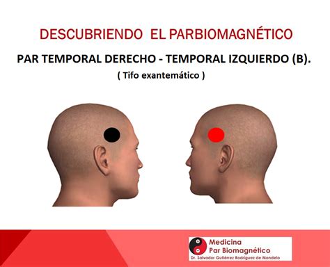 Par Temporal derecho temporal izquerdo Medicina Par Biomagnético