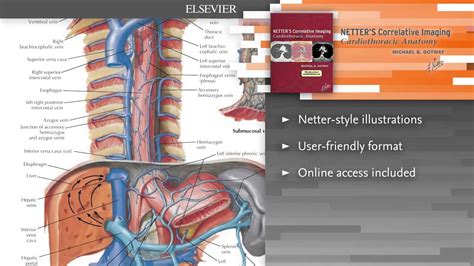 Netters Correlative Imaging Cardiothoracic Anatomy Youtube