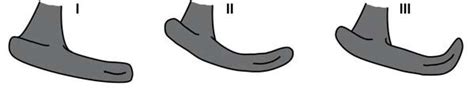 Acromial Shapes As Classified By Bigliani And Morrison Type I Flat