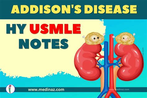 Addison S Disease Usmle Notes