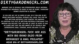 DGG Speculum Cervix Anal Prolapse Sounding 27 August 2024 XNXX
