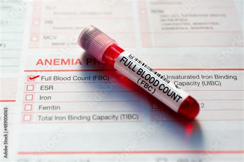 Blood Sample For Analysis Of Serum Iron Test In Laboratory Blood Tube