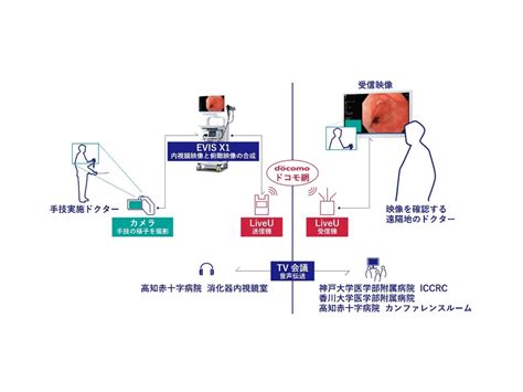 オリンパスやnttドコモ他3医療機関が4k映像による消化器内視鏡映像のリアルタイム伝送の実証実験に成功 Techcrunch Japan