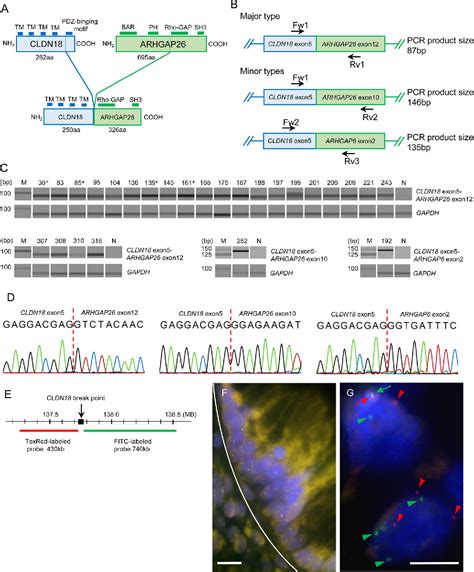 Figure From Frequent Cldn Arhgap Fusion In Highly Metastatic