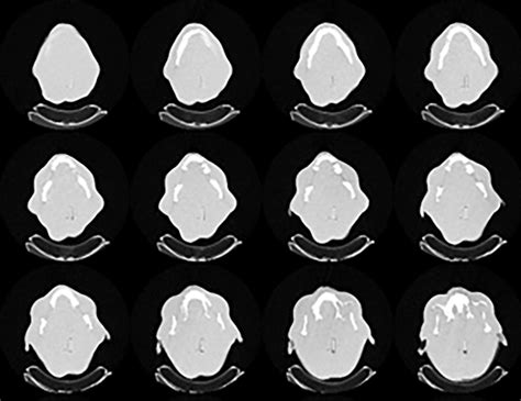 Ct Scan Of Some Slices Of The Constructed Phantom Download Scientific Diagram