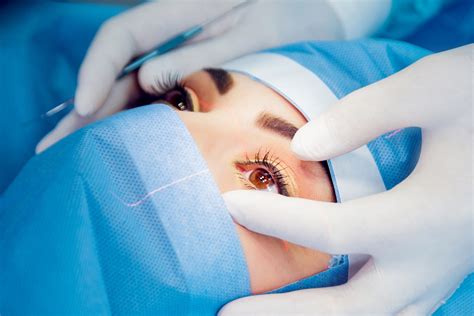 Операции на глазах: без боли, дискомфорта и швов!