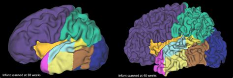 Cloud Based Tools For Cerebral Palsy Neuroimaging Australian E Health