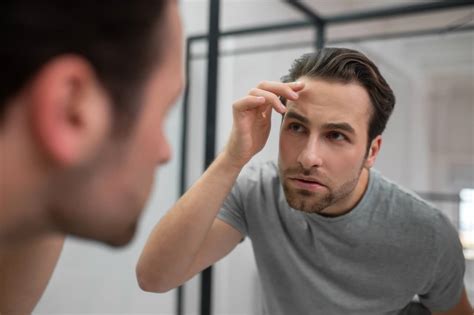 Minoxidil Es Efectivo Para Frenar La Ca Da Del Pelo Capilea