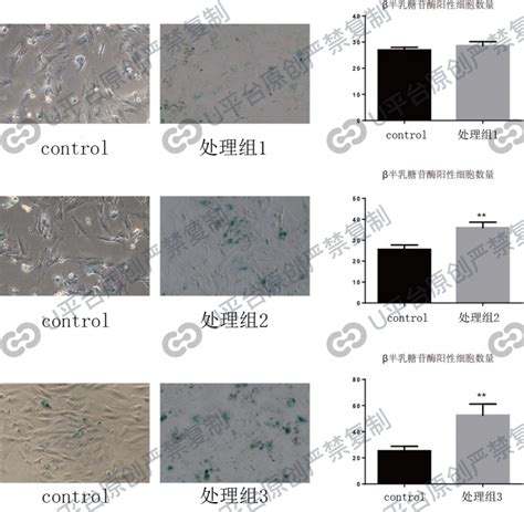 细胞衰老的检测方法，你都了解吗？