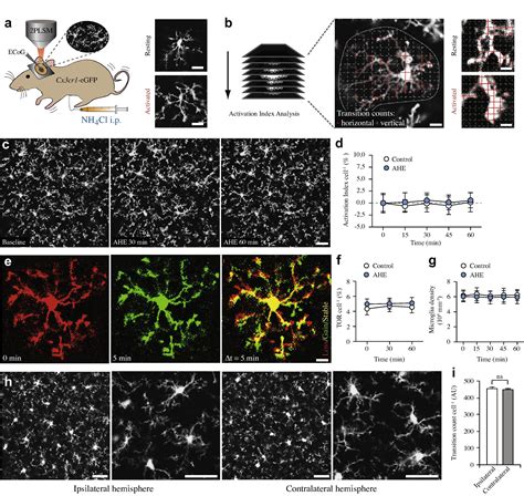 Real Time Analysis Of Microglial Activation And Motility In Hepatic And