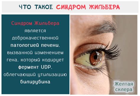 Пентафлуцин: инструкция по применению, отзывы и аналоги