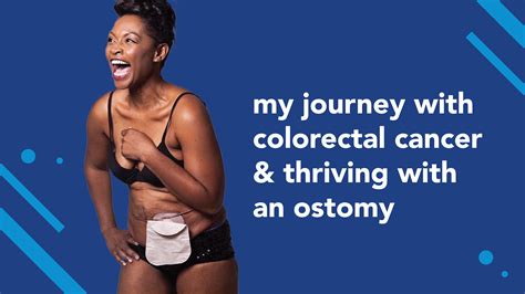 My Journey With Colorectal Cancer And Thriving With An Ostomy