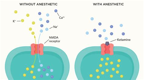 General Anesthesia Causes Telltale Brain Activity Patterns | The ...