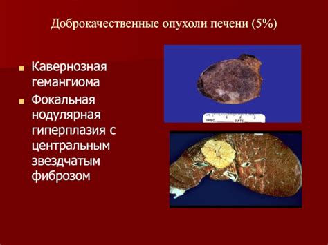 Болезни печени