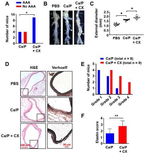 Nucleolar Stress Induces A Senescence Like Phenotype In Smooth Muscle