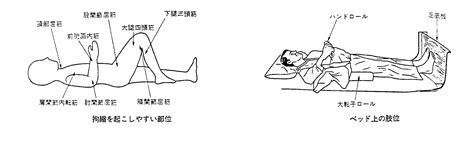 良肢位一覧と図（画像） ～関節可動域 角度 の維持・予防のために～ 医療従事者と患者の広場 ～看護師や作業 理学療法士etcの国家試験