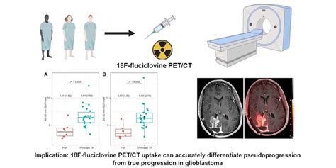 Pet Tracer Shows Promise In Imaging Of Brain Tumors