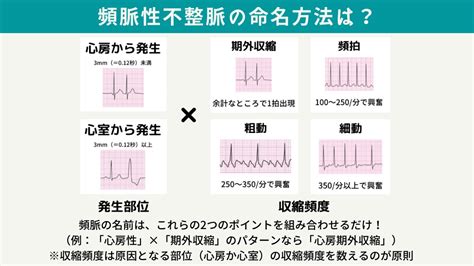 【保存版】心電図読み方のコツ・異常不整脈一覧【救急隊・看護師必見！】 救急救命士学習塾