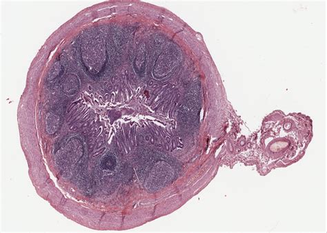 Lymphoid Organs – Meyers Histology