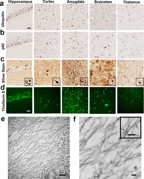 Histological And Ultrastructural Characterization Of Tau Spam Mice