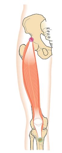 Exam 5 Lower Extremity Flashcards Quizlet