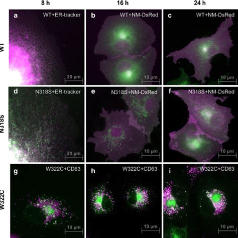 Subcellular Localization Of Wild Type And Mutant Kir2 1 Channels In