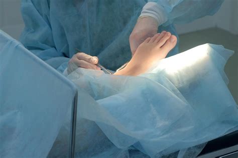 Types of Ankle Surgery | Rocky Mountain Foot & Ankle